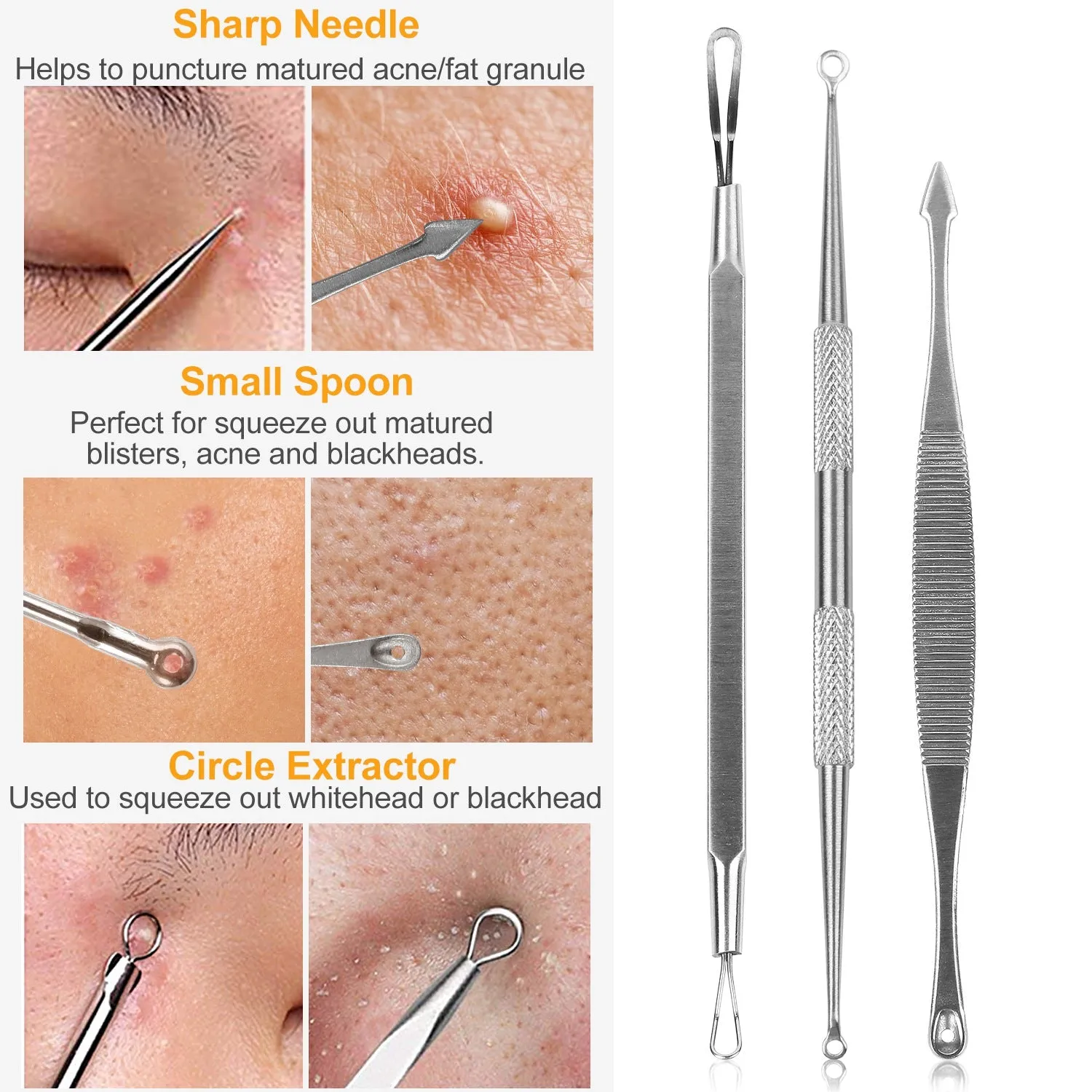 5-Piece Set: Blackhead Remover Kit Stainless Steel Popping Zit Remover